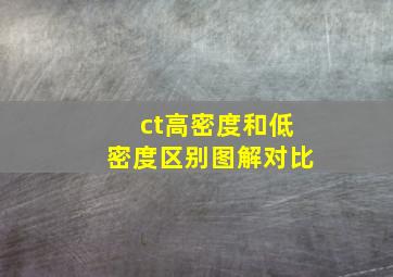 ct高密度和低密度区别图解对比