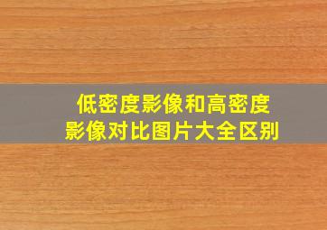 低密度影像和高密度影像对比图片大全区别