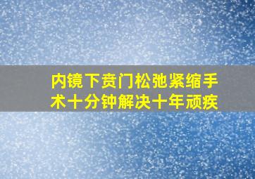 内镜下贲门松弛紧缩手术十分钟解决十年顽疾