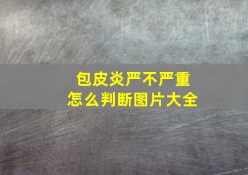 包皮炎严不严重怎么判断图片大全