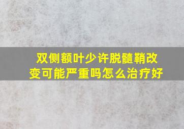 双侧额叶少许脱髓鞘改变可能严重吗怎么治疗好