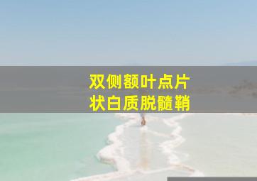 双侧额叶点片状白质脱髓鞘