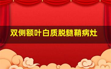 双侧额叶白质脱髓鞘病灶