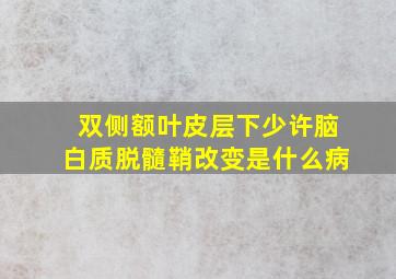 双侧额叶皮层下少许脑白质脱髓鞘改变是什么病