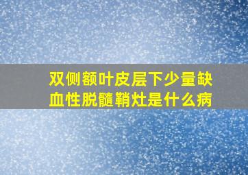 双侧额叶皮层下少量缺血性脱髓鞘灶是什么病