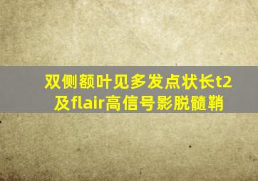 双侧额叶见多发点状长t2及flair高信号影脱髓鞘