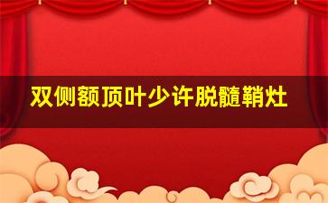 双侧额顶叶少许脱髓鞘灶