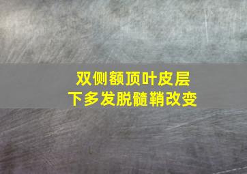 双侧额顶叶皮层下多发脱髓鞘改变