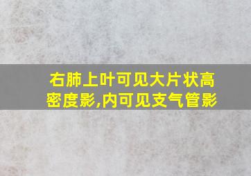 右肺上叶可见大片状高密度影,内可见支气管影