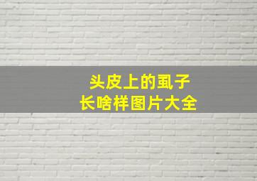 头皮上的虱子长啥样图片大全