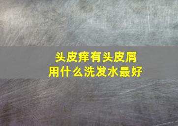 头皮痒有头皮屑用什么洗发水最好