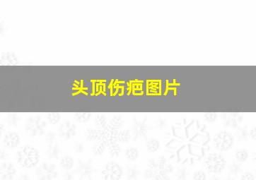 头顶伤疤图片