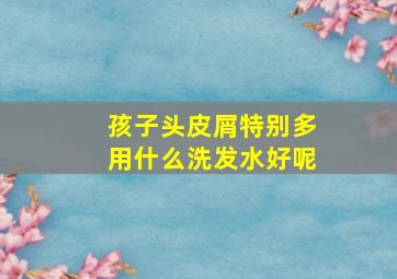 孩子头皮屑特别多用什么洗发水好呢