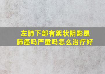 左肺下部有絮状阴影是肺癌吗严重吗怎么治疗好