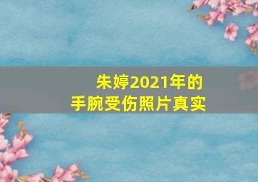 朱婷2021年的手腕受伤照片真实