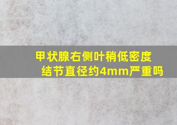 甲状腺右侧叶稍低密度结节直径约4mm严重吗