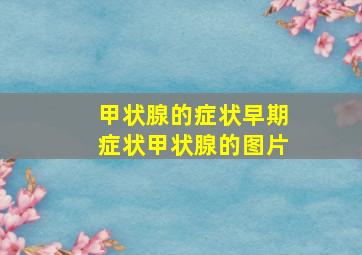 甲状腺的症状早期症状甲状腺的图片