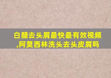 白醋去头屑最快最有效视频,阿莫西林洗头去头皮屑吗