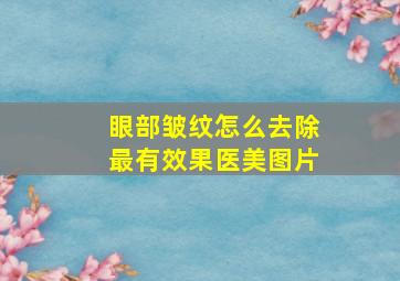 眼部皱纹怎么去除最有效果医美图片