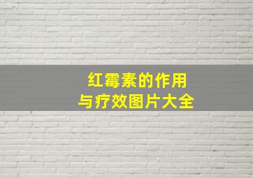 红霉素的作用与疗效图片大全