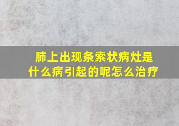 肺上出现条索状病灶是什么病引起的呢怎么治疗