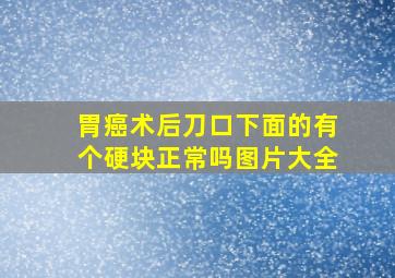 胃癌术后刀口下面的有个硬块正常吗图片大全