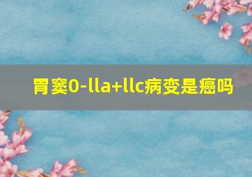 胃窦0-lla+llc病变是癌吗