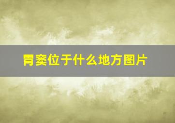 胃窦位于什么地方图片