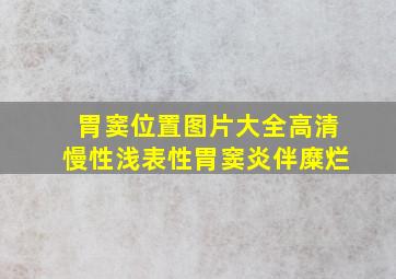 胃窦位置图片大全高清慢性浅表性胃窦炎伴糜烂