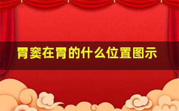 胃窦在胃的什么位置图示