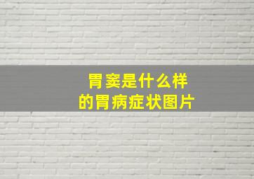 胃窦是什么样的胃病症状图片