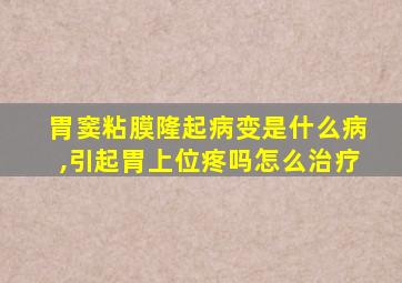 胃窦粘膜隆起病变是什么病,引起胃上位疼吗怎么治疗