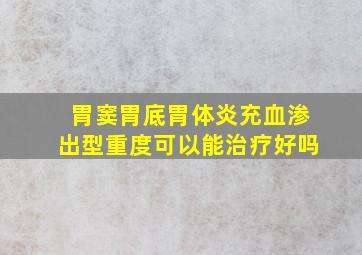 胃窦胃底胃体炎充血渗出型重度可以能治疗好吗