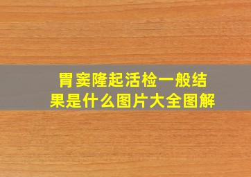 胃窦隆起活检一般结果是什么图片大全图解