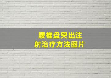 腰椎盘突出注射治疗方法图片