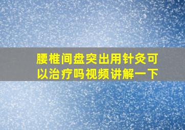 腰椎间盘突出用针灸可以治疗吗视频讲解一下