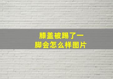 膝盖被踢了一脚会怎么样图片