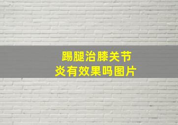 踢腿治膝关节炎有效果吗图片