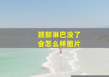 颈部淋巴没了会怎么样图片